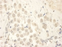 HBO Polyclonal Antibody, Bethyl Laboratories:Antibodies:Primary Antibodies