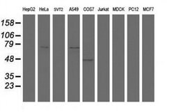 HBS1L Monoclonal Antibody (OTI1F11), TrueMAB , OriGene 100 &mu;L; Unconjugated:Antibodies,