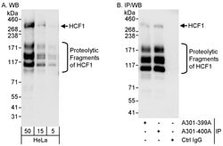 HCF1 Rabbit anti-Human, Polyclonal, Bethyl Laboratories 100 &mu;l; Unlabeled:Antibodies,