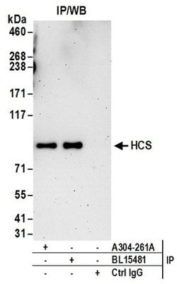 HCS Rabbit anti-Human, Polyclonal, Bethyl Laboratories 100 &mu;L; Unconjugated:Antibodies,