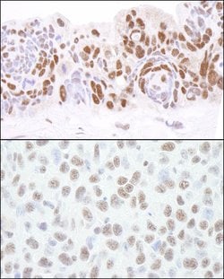 HDAC1 Rabbit anti-Human, Mouse, Polyclonal, Bethyl Laboratories 100 &mu;L;
