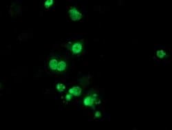 HDAC1 Monoclonal Antibody (OTI5C3), TrueMAB , OriGene:Antibodies:Primary