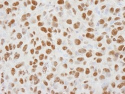 HDAC1 Polyclonal Antibody, Bethyl Laboratories:Antibodies:Primary Antibodies
