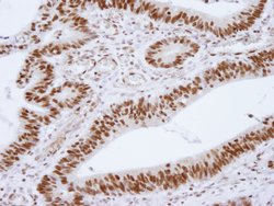 HDAC1 Polyclonal Antibody, Bethyl Laboratories 100 &mu;L; Unconjugated:Antibodies,