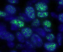 HDAC1 Polyclonal Antibody, Bethyl Laboratories 100 &mu;L; Unconjugated:Antibodies,
