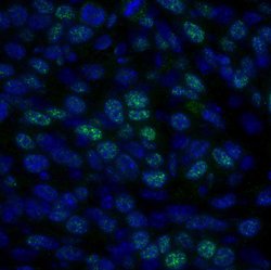 HDAC1 Polyclonal Antibody, Bethyl Laboratories 100 &mu;L; Unconjugated:Antibodies,