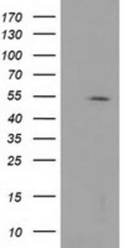 HDAC1 Mouse anti-Canine, Human, Mouse, Rat, Clone: OTI5F9, lyophilized,