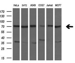 HDAC10 Mouse anti-Human, Clone: OTI6G5, lyophilized, TrueMAB 100 &mu;g;