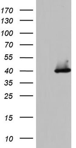 HDAC11 Monoclonal Antibody (OTI7A7), TrueMAB , OriGene:Antibodies:Primary