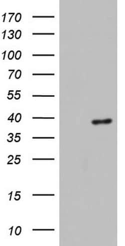 HDAC11 Mouse anti-Human, Clone: OTI1D5, lyophilized, TrueMAB 100 &mu;g;
