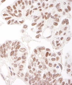 HDAC2 Rabbit anti-Human, Mouse, Polyclonal, Bethyl Laboratories 100 &mu;L;