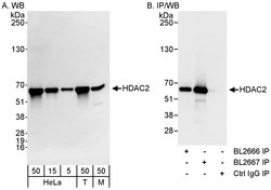 HDAC2 Rabbit anti-Human, Mouse, Polyclonal, Bethyl Laboratories 100 &mu;L;