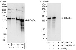 HDAC4 Rabbit anti-Human, Polyclonal, Bethyl Laboratories 100 &mu;L; Unconjugated:Antibodies,