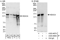 HDAC4 Rabbit anti-Human, Polyclonal, Bethyl Laboratories 100 &mu;L; Unconjugated:Antibodies,