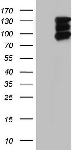 HDAC4 Monoclonal Antibody (OTI1E1), TrueMAB , OriGene 100 &mu;L; Unconjugated:Antibodies,