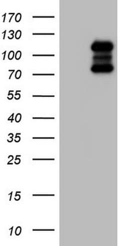 HDAC4 Monoclonal Antibody (OTI1E12), TrueMAB , OriGene 100 &mu;L; Unconjugated:Antibodies,