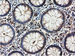 HDAC6 Mouse anti-Canine, Human, Rat, Clone: OTI4C5, lyophilized, TrueMAB 100 &mu;g | Buy Online | Origene Technologies | Fisher Scientific