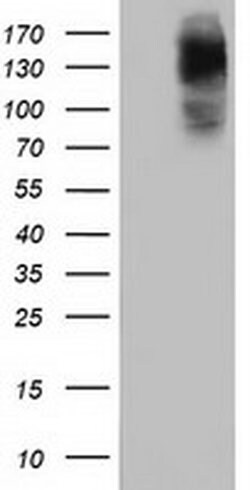 HDAC6 Mouse anti-Canine, Human, Rat, Clone: OTI1D11, liquid, TrueMAB 100