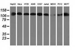 HDAC6 Mouse anti-Canine, Human, Rat, Clone: OTI1D11, liquid, TrueMAB 100