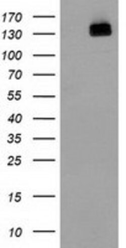 HDAC6 Mouse anti-Human, Clone: OTI3G7, lyophilized, TrueMAB 100 &mu;g;