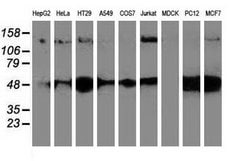 HDAC6 Mouse anti-Human, Clone: OTI3G7, lyophilized, TrueMAB 100 &mu;g;