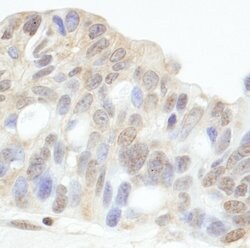 HDAC7 Rabbit anti-Human, Polyclonal, Bethyl Laboratories 100 &mu;l; Unlabeled:Antibodies,