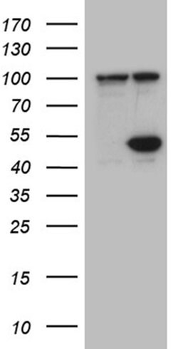 HDAC8 Monoclonal Antibody (OTI1A4), TrueMAB , OriGene 100 &mu;L; Unconjugated:Antibodies,