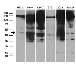 HDAC8 Monoclonal Antibody (OTI1A4), TrueMAB , OriGene 100 &mu;L; Unconjugated:Antibodies,