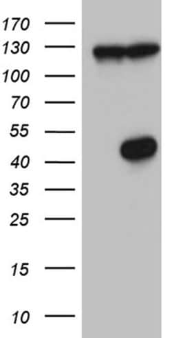 HDAC8 Monoclonal Antibody (OTI9H8), TrueMAB , OriGene 100 &mu;L; Unconjugated:Antibodies,