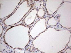 HDAC9 Monoclonal Antibody (OTI6E2), TrueMAB , OriGene 100 &mu;L; Unconjugated:Antibodies,