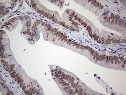 HDAC9 Monoclonal Antibody (OTI6E2), TrueMAB , OriGene 100 &mu;L; Unconjugated:Antibodies,