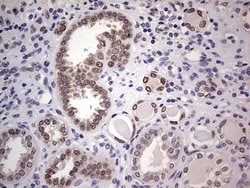 HDAC9 Monoclonal Antibody (OTI6E2), TrueMAB , OriGene 100 &mu;L; Unconjugated:Antibodies,