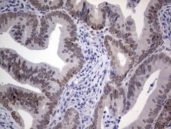 HDAC9 Monoclonal Antibody (OTI3D10), TrueMAB , OriGene:Antibodies:Primary