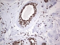 HDAC9 Mouse anti-Human, Clone: OTI7G2, lyophilized, TrueMAB 100 &mu;g;