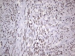 HDAC9 Mouse anti-Human, Clone: OTI7G2, lyophilized, TrueMAB 100 &mu;g;