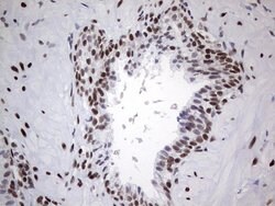 HDAC9 Mouse anti-Human, Clone: OTI7G2, lyophilized, TrueMAB 100 &mu;g;