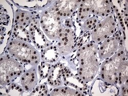 HDAC9 Monoclonal Antibody (OTI2A7), TrueMAB , OriGene:Antibodies:Primary