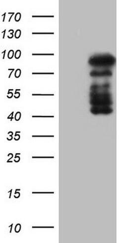 HDAC9 Mouse anti-Human, Clone: OTI7G2, lyophilized, TrueMAB 100 &mu;g;