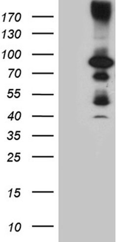 HDAC9 Monoclonal Antibody (OTI7G9), TrueMAB , OriGene:Antibodies:Primary
