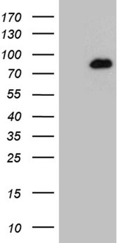 HDAC9 Monoclonal Antibody (OTI2A7), TrueMAB , OriGene 100 &mu;L; Unconjugated:Antibodies,