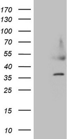 HDGF Mouse anti-Human, Clone: OTI8C7, lyophilized, TrueMAB 100 &mu;g; Unconjugated:Antibodies,