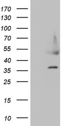 HDGF Monoclonal Antibody (OTI8C7), TrueMAB , OriGene 30 &mu;L | Buy Online | Origene Technologies | Fisher Scientific
