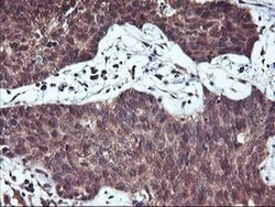 HDHD1 Monoclonal Antibody (OTI3E11), TrueMAB , OriGene 100 &mu;L; Unconjugated:Antibodies,