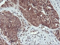 HDHD1 Monoclonal Antibody (OTI3E11), TrueMAB , OriGene 100 &mu;L; Unconjugated:Antibodies,