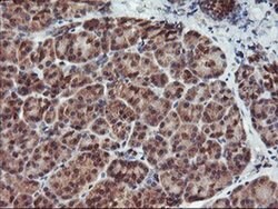 HDHD1 Monoclonal Antibody (OTI3E11), TrueMAB , OriGene:Antibodies:Primary