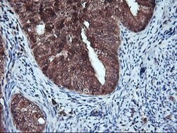 HDHD1 Monoclonal Antibody (OTI3E11), TrueMAB , OriGene:Antibodies:Primary