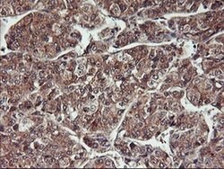 HDHD1 Monoclonal Antibody (OTI3E11), TrueMAB , OriGene 100 &mu;L; Unconjugated:Antibodies,