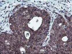 HDHD1 Monoclonal Antibody (OTI7A2), TrueMAB , OriGene 100 &mu;L; Unconjugated:Antibodies,