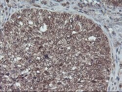 HDHD1 Monoclonal Antibody (OTI7A2), TrueMAB , OriGene 100 &mu;L; Unconjugated:Antibodies,