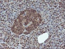 HDHD1 Monoclonal Antibody (OTI7A2), TrueMAB , OriGene 100 &mu;L; Unconjugated:Antibodies,